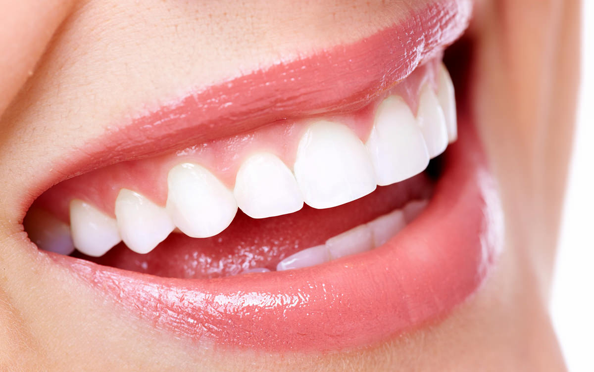 L'esthétique dentaire au cabinet foulon à ribemont